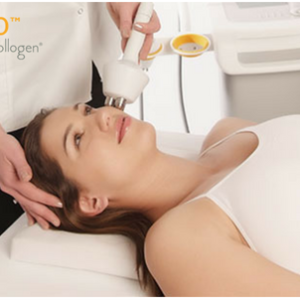 radiofrequência rosto facial