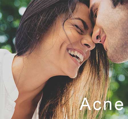 Tratamento para Acne