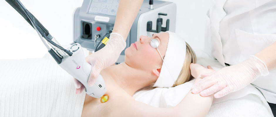 Como funciona a depilação a laser?