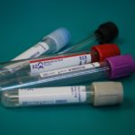 diagnóstico síndrome do intestino irritável