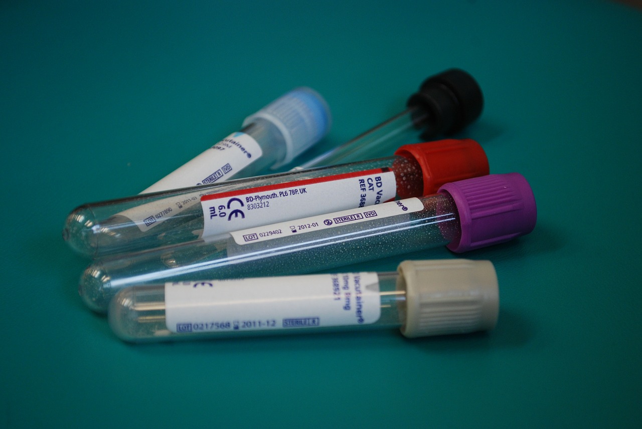 diagnóstico síndrome do intestino irritável