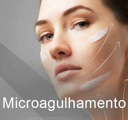 Microagulhamento