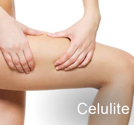 Tratamento para a celulite