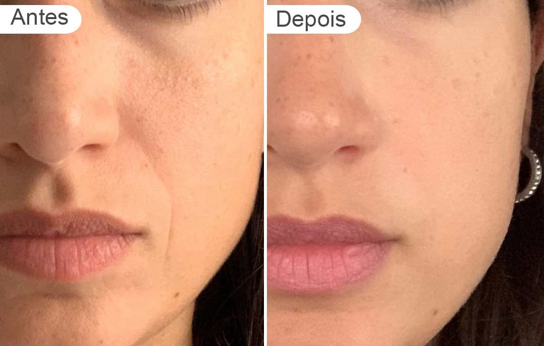 página de resultados - antes e depois | rosto mulher. frente