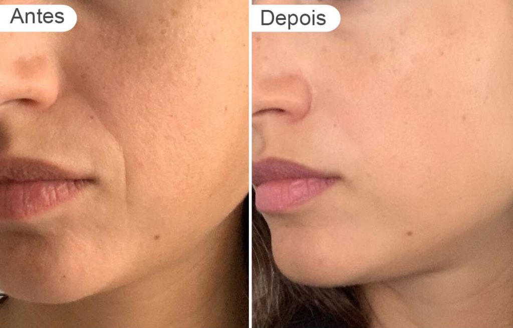 página de resultados - antes e depois | rosto mulher, lado
