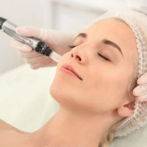 Microagulhamento com a Dermapen